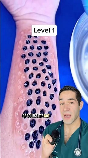 The 4 levels of trypophobia 😳