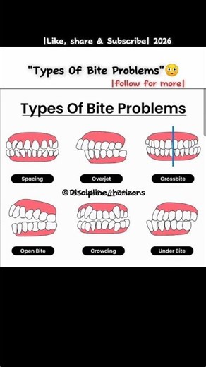 "Different Types Of Bite Problem" 😳