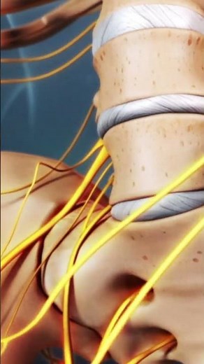 How does Sciatica develop?