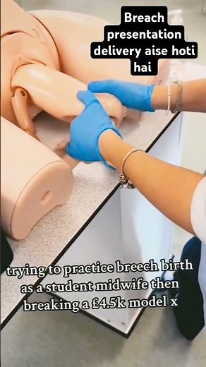 Breech presentation delivery procedure ..#medicalstudent #doctor #hospital #delivery #pregnancy