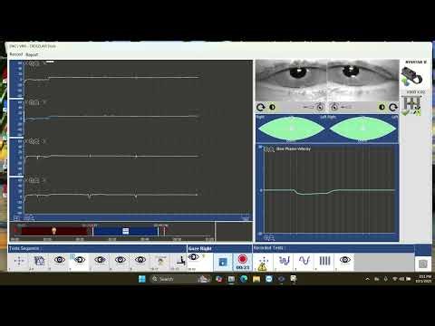 VNG Testing