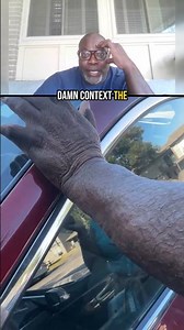 MAN'S ARM SO ASHY IT LOOKS LIKE ALLIGATOR SKIN