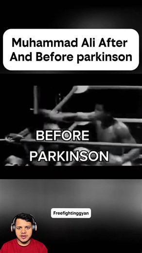 Muhammad Ali After And Before parkinson #boxing #fight #knockout #shorts