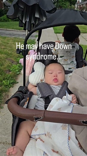 He’s not a diagnosis—he’s simply his baby brother 🤍 #DownSyndrome #SiblingLove