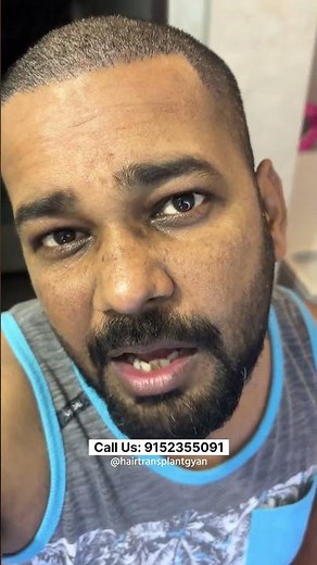 Day 8 - Hair and Blood Clotting Falling after hair transplant