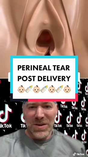 Suturing Perineal Laceration: Perineal Tear Post Delivery
