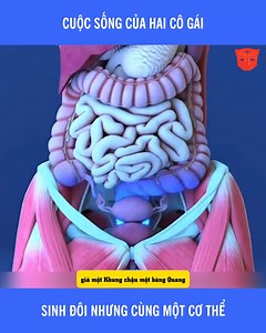 574K views · 1.8K reactions | sinh đôi nhưng cùng một cơ thể #xuhuong #fblifestyle | Thích Review | Facebook