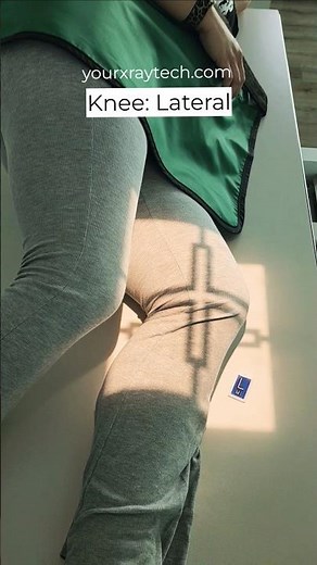 X-Ray Knee Lateral Projection