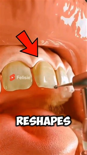 Making Shark Teeth Look Pretty? You Won’t Believe It! 😱🦈🦷