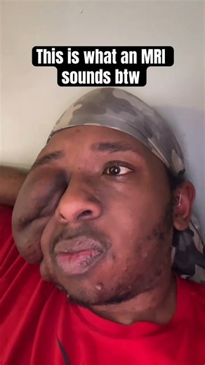 POV: What it Sound Like Inside MRI