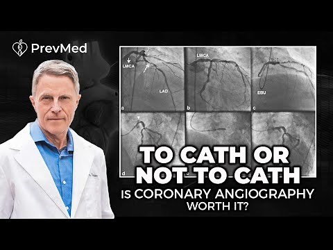 To Cath or Not to Cath - Is Coronary Angiography Worth It?