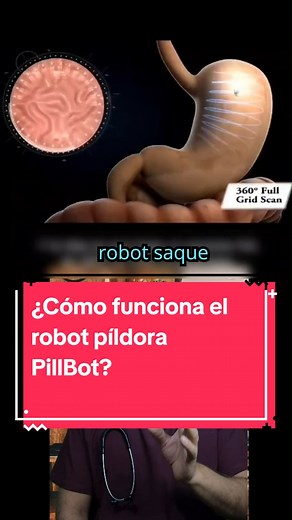 ¿Cómo funciona el robot píldora PillBot? Actúa como un submarino en miniatura, ya que se pilotea en el cuerpo mediante un control remoto inalámbrico luego de su toma