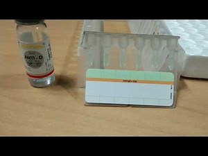 Du test by CAT method