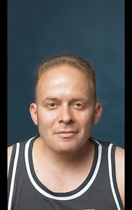 The effect of one missing tooth, combined with yellowed teeth, drastically affected this patient’s smile 😥 After a Hollywood smile makeover at Medico Clinic, his smile is now bright and perfectly restored 🤩 📲 Contact us today for your consultation in Turkey. wa.me/905526630630 . . . . . . . . #Medicoclinic #hollywoodsmile #dentalimplants #veneers #emaxveneers #zirconiumcrowns #zirconium #zirconiumcrownsturkey #TeethWhitening #dentalclinic #allon6 #allon4 #teethreplacement #istanbul #turkey | 