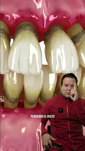 Periodontal disease, what is the solution?
