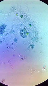 Beach water under the microscope! (So much life!)