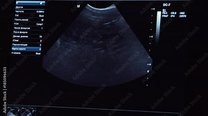 Ultrasound diagnostics with the image of internal organs on the screen of the monitor in a veterinary clinic. Medical ultrasound machine. Screen ultrasound machine. symbol diagnostics in healthcare. Stock Video