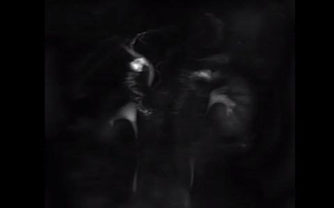 109 （正常MRCP）Normal MRCP