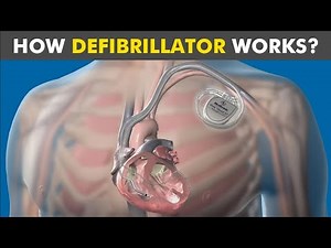 How Defibrillator Works: Automated External Defibrillation working mechanism