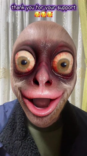 Bald Man with Big Eyes Pleads for Support