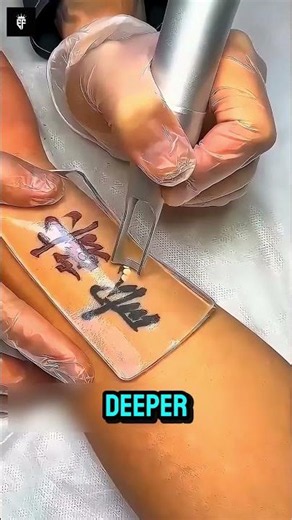 The Latest Tattoo Removal Technique.
