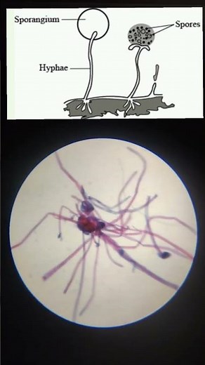 Rhizopus slide under Microscope|Microorganism