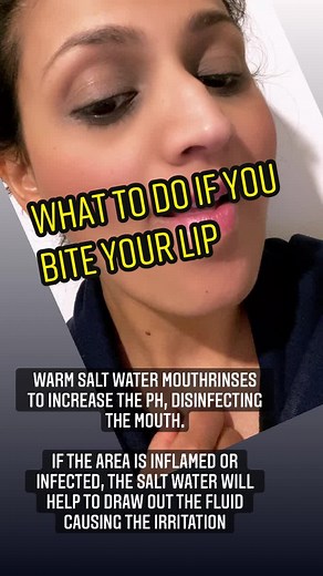 How to Treat Bitten Lips: Remedies and Tips