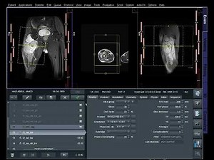 How to MRI of Long Bone | MRI Planning and Positioning Tutorial | Radiology Education