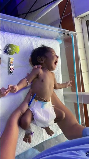 Moro Reflex in newborns/neonates