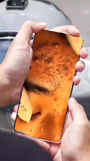 43K views · 325 reactions | “Most satisfying blackhead pop you’ll see today 勞” #PimplePopping #Satisfying #OddlySatisfying #BlackheadRemoval | Cystic Popping Blackheads | Facebook