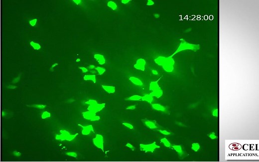 使用试剂盒转染人脐静脉内皮细胞HUVEC Transfection Optimized with Cytofect™ Kit