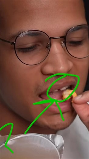 where is ‪@Bento_Club‬ front teeth?