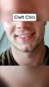 The Rarest Human Genetics 😳