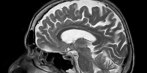 Scientists have just built a working computer using human brain tissue