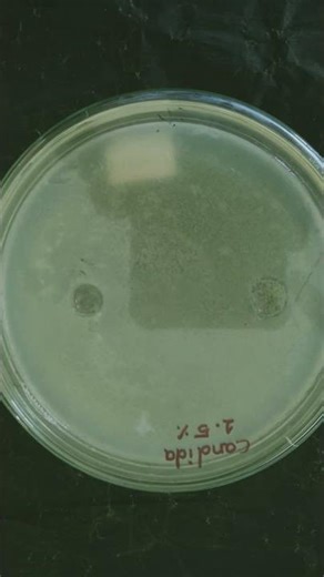 #WellDiffusionMethod#AgarWellDiffusion#AntimicrobialAssay#AntimicrobialPeptides#AMPResearch#PeptideS