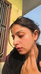 how to remove Dark Circle 🙂🤌in 5minutes