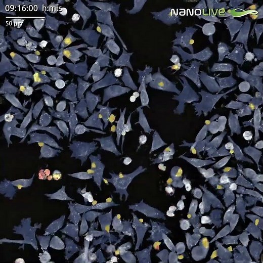 high resolution label free segmentation of t cells and target cells over time using nanolive's live