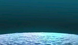 椎间孔挤压试验(Spurling's Tes)