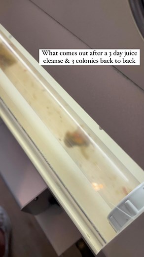 10K views · 87 reactions | A toxic colon is the root cause for so...