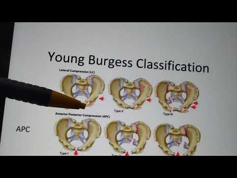 Pelvic fractures classification