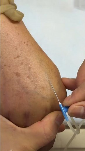 How to Give IV Technique Pro | Intravenous Nursing Skills | Perfect IV & Intramuscular IM #shorts