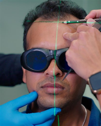 Advanced Hair | 🏆At Advanced Hair Restoration, hairline design isn’t just a procedure—it’s an art form. 🎙️ Our team combines advanced FUE technology with a... | Instagram