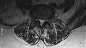 Purified MRI of the female pelvic organs, abdominal cavity, gastrointestinal tract and bladder