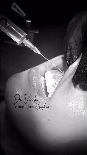 An upper anterior frenectomy using a blade is a surgical procedure