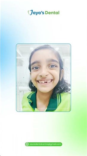 Operculectomy | Clearing the Way for a Stuck Tooth