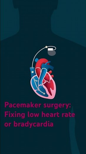 Pacemaker surgery: Fixing low heart rate or bradycardia