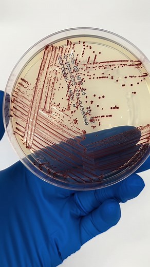 Evolution of Agar in Microbiology Labs