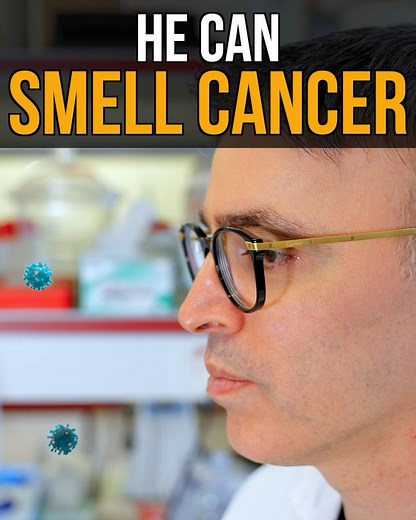 4.6M views · 159K reactions | He can smell cancer….how?! I am so proud to bring you the story of Professor HossamHaick from The Technion Institute. Like me, he is also a “Palestinian Israeli”, and it’s people like him that are going to change the world!!! IG: @hossam.haick | Nas Daily | Facebook