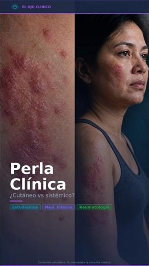 cutáneo o sistémico?