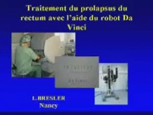 Première journée francophone de chirurgie robotique - prolapsus rectal | Canal U
